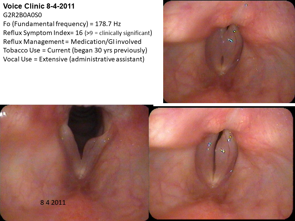 Dysphonia 2011