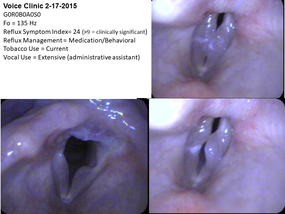 Dysphonia 2015