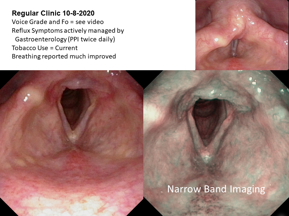 Dysphonia 2020