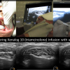 ultrasound sialography