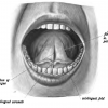 Sublingual Folds (By Dr. Johannes Sobotta - Sobotta&#039;s Atlas and Text-book of Human Anatomy 1906, Public Domain, https://commons.wikimedia.org/w/index.php?curid=29847522)