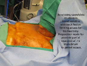035 intraop