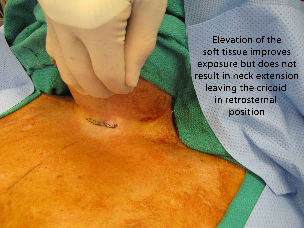 036 intraop