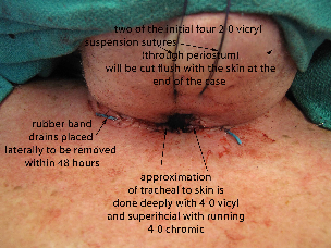 040 intraop
