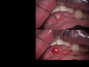 Slide5