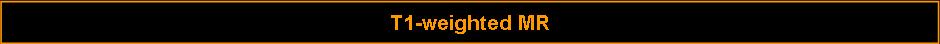 T1-weighted MR