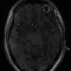 7T Neuro Images - Axial T1 BRAVO Human Head TE = 2.4 TR = 6.