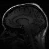 7T Neuro Images - Sagittal T1 BRAVO Human Head TE = 2.4 TR = 6.3