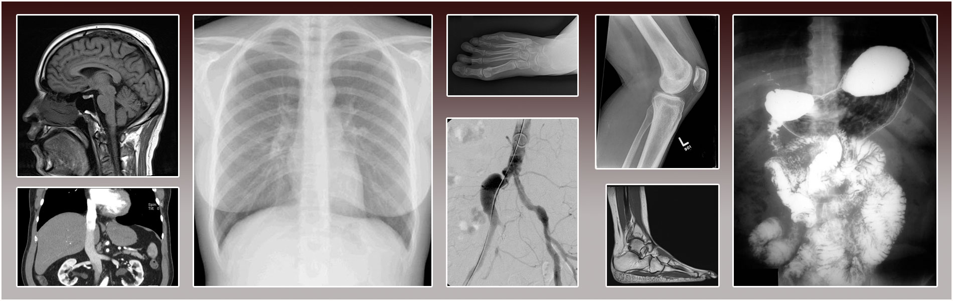 Collage of radiographic images